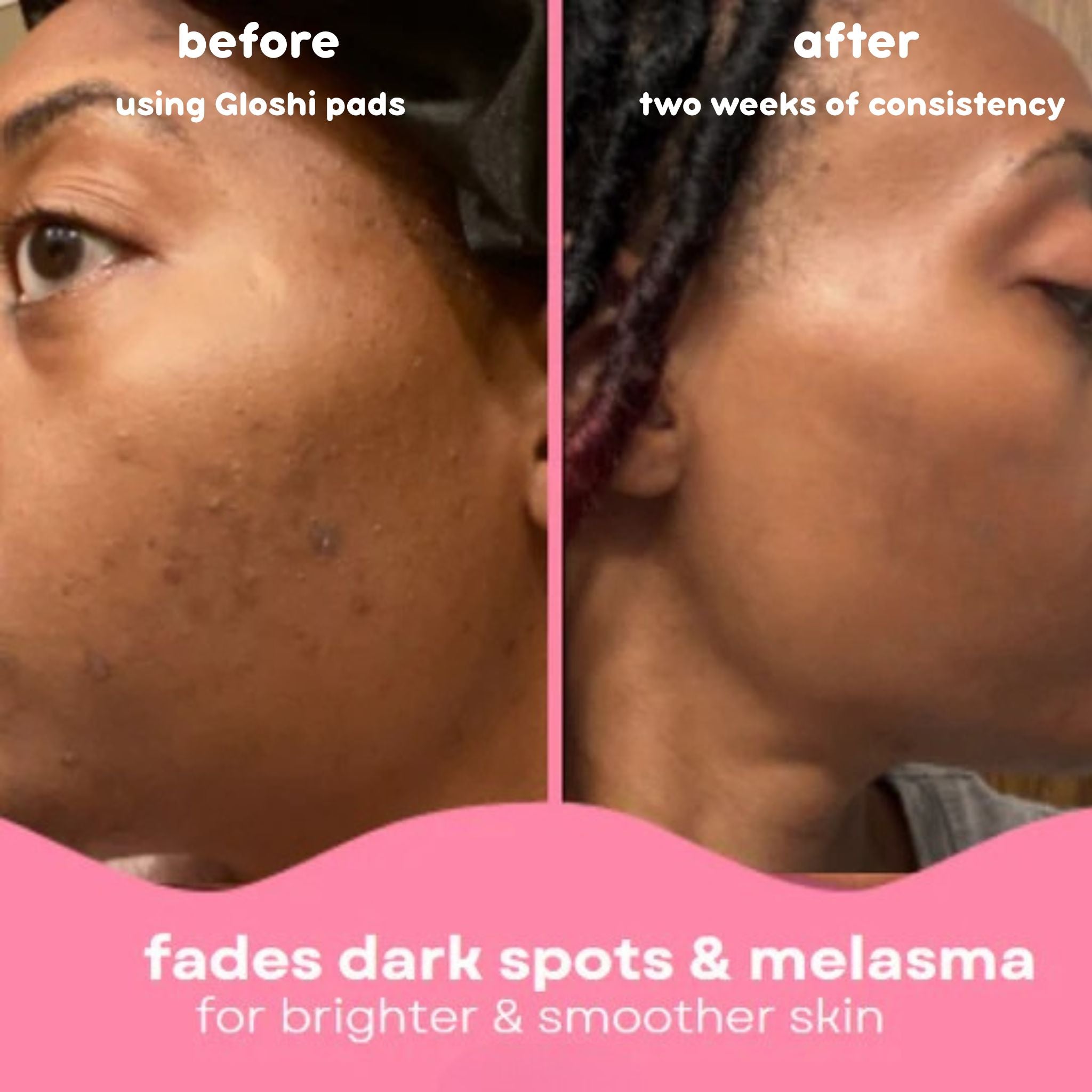 Turmeric + Kojic Acid Smoothing Pads
