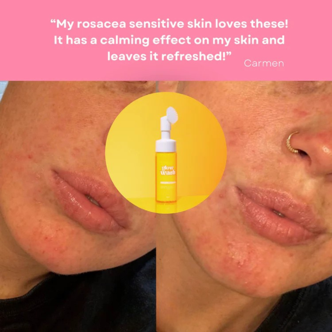 Gloshi Turmeric & Kojic Acid Glow Wash