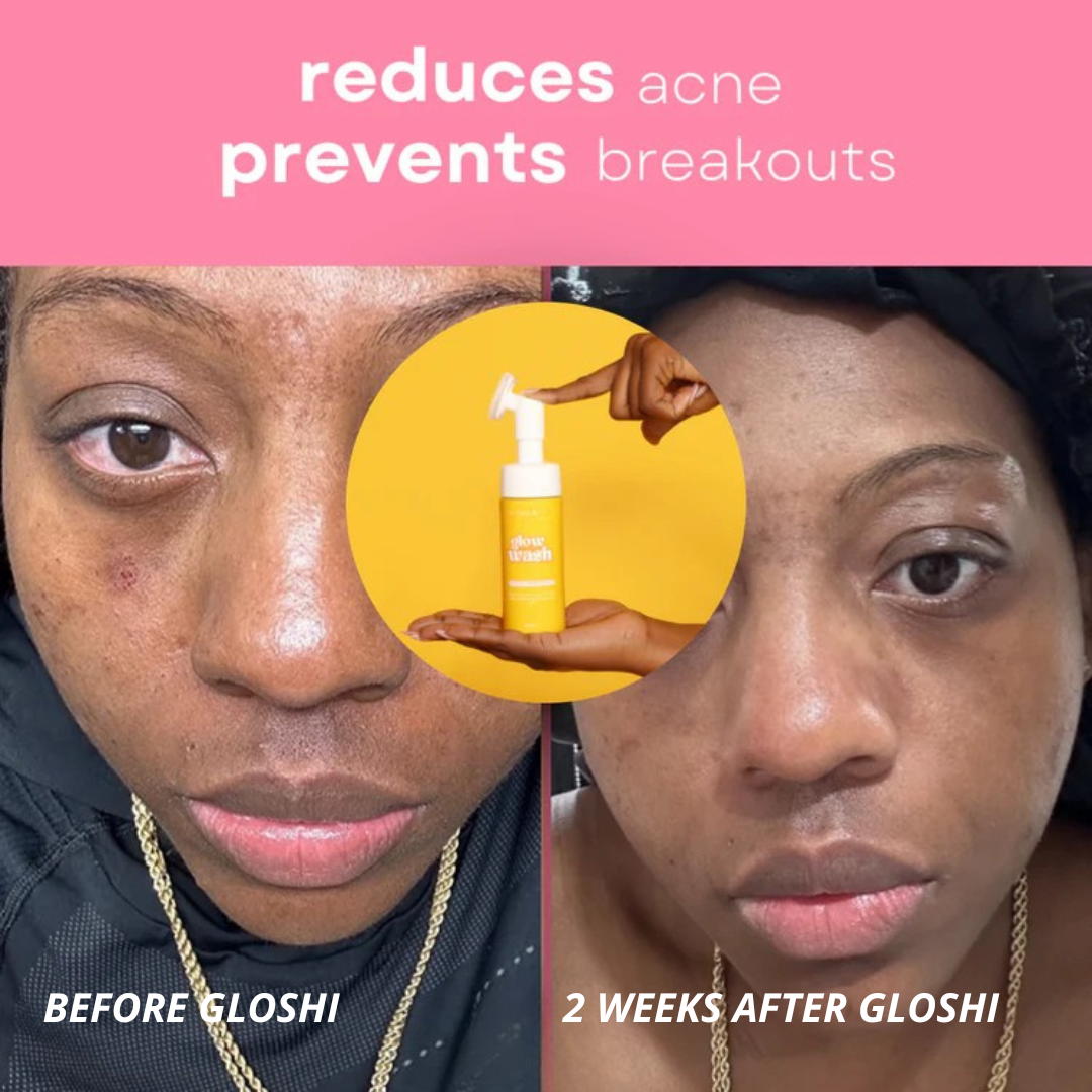 Gloshi Turmeric & Kojic Acid Glow Wash