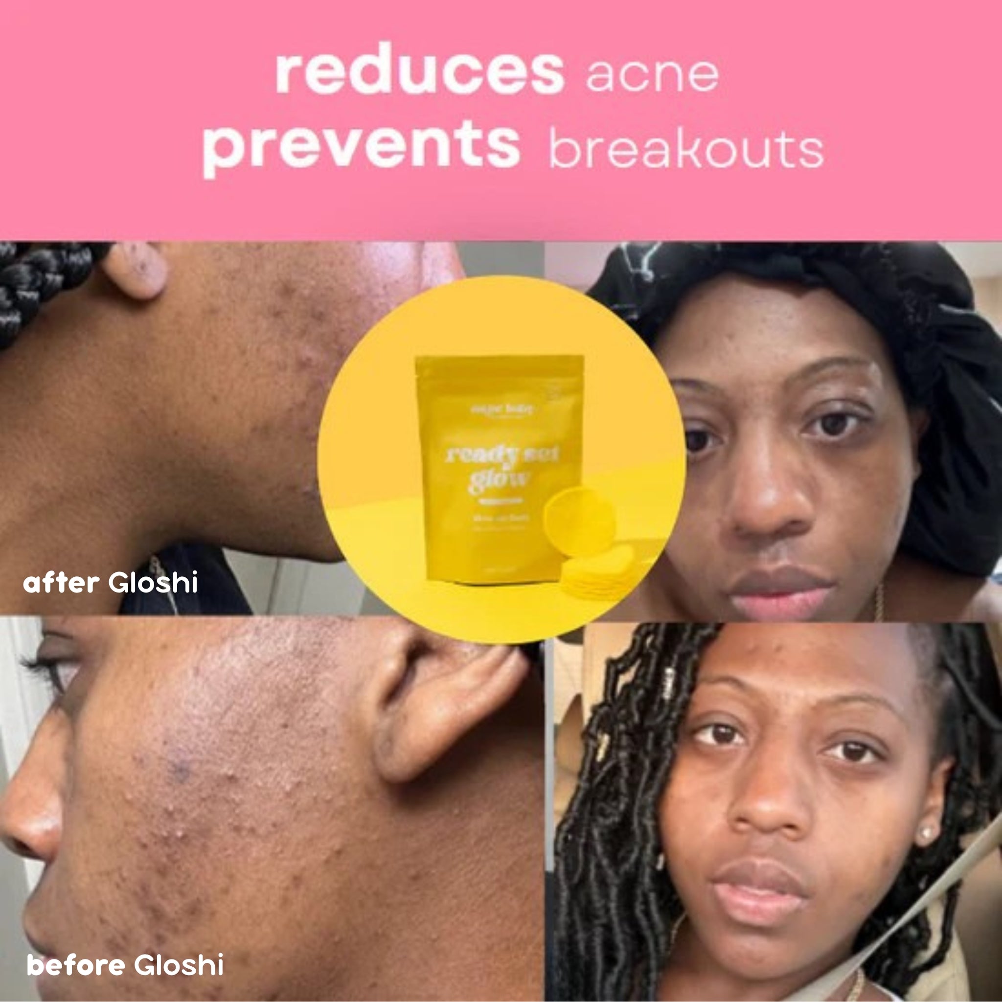 Turmeric + Kojic Acid Smoothing Pads